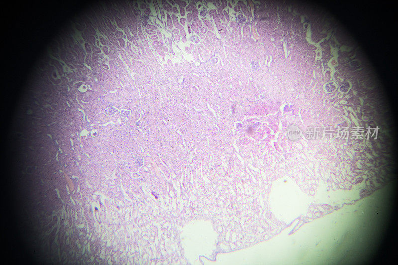 显微镜下肾脏横切面