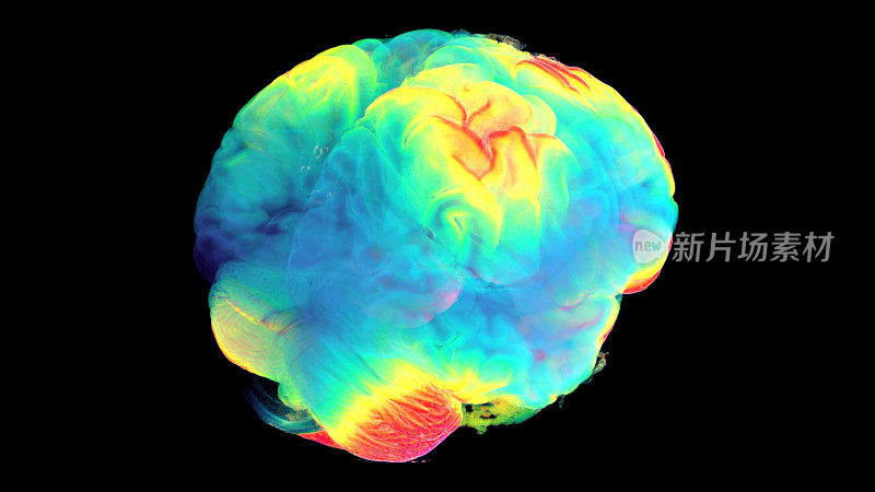利用MTR和断层扫描技术，对人类大脑进行数字研究的三维可视化。作为这项研究的结果，获得了关于患者在临床阶段和六个月缓解后的大脑变化的完整信息。