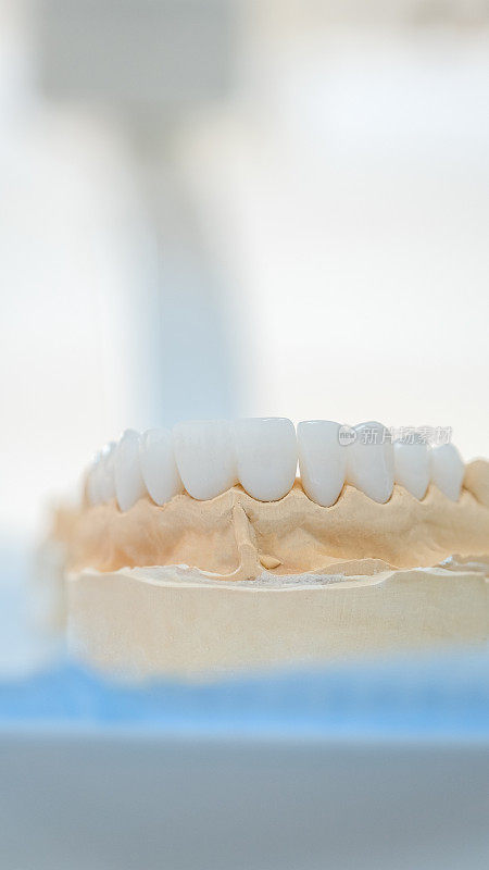 氧化锆齿从底部角度插入模具