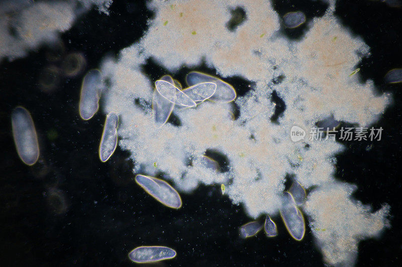 草履虫是一种单细胞纤毛原生动物