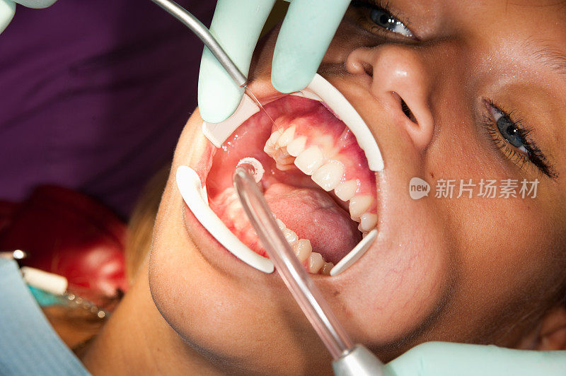 牙科治疗