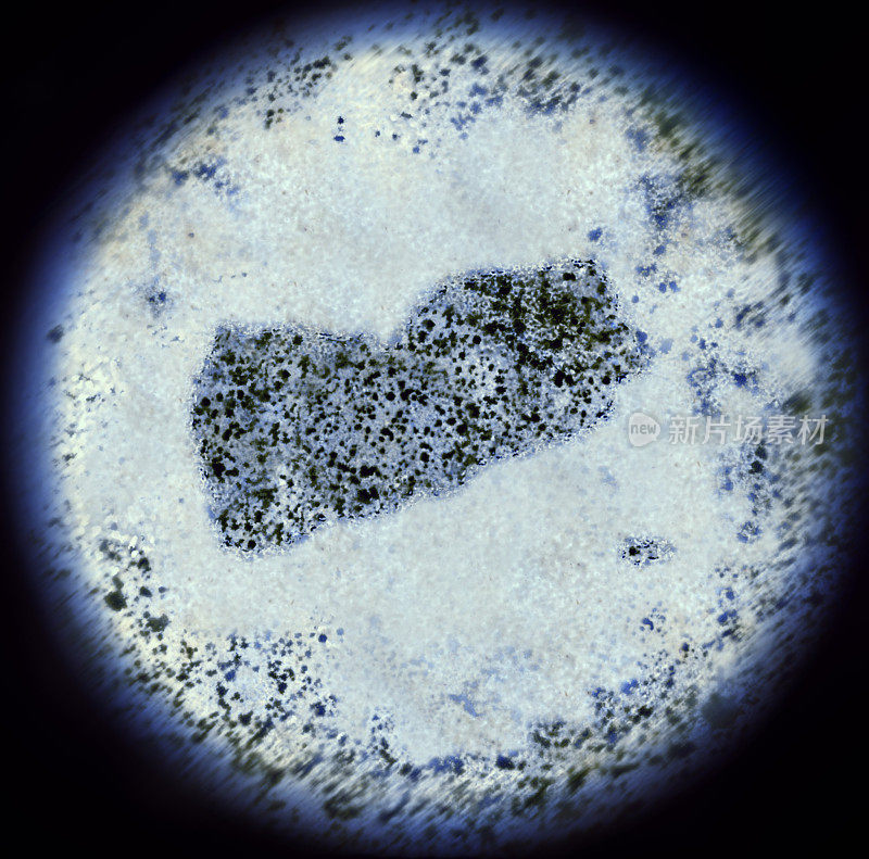 通过显微镜观察也门形状的细菌。(系列)
