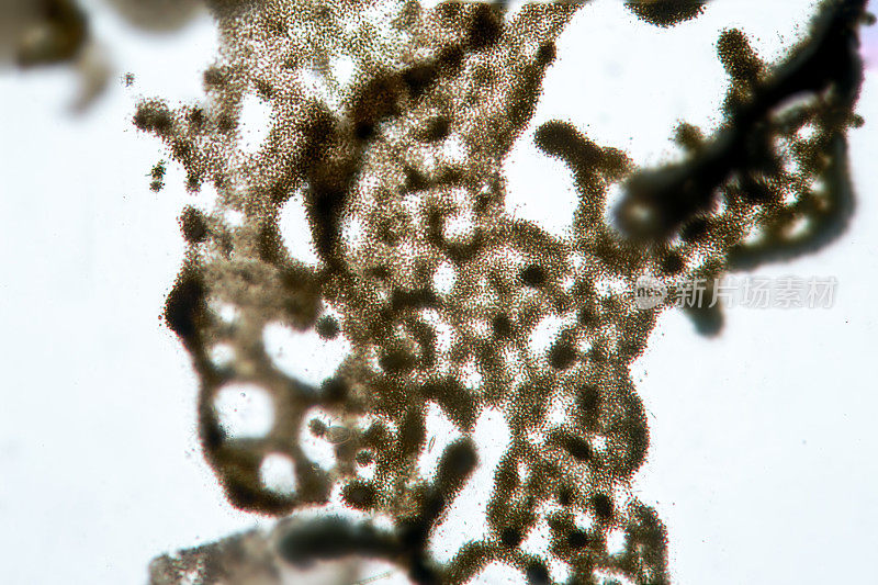 单细胞藻类微囊藻蓝藻显微镜观察。淡水藻类污染的原因