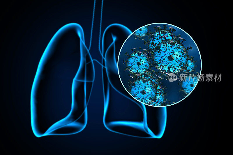 冠状病毒对肺部