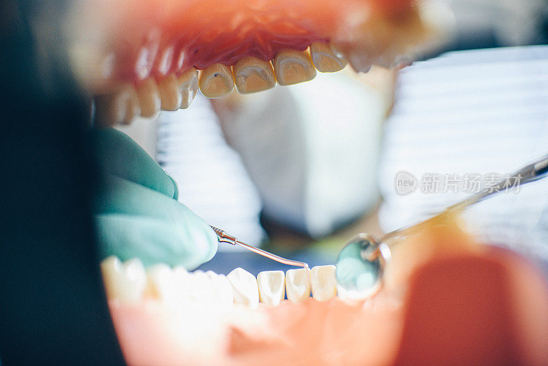 牙医检查牙齿-从口腔内角度