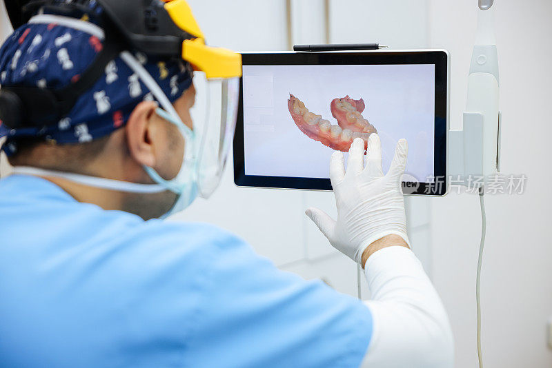 牙医用3d扫描仪扫描病人的牙齿。
