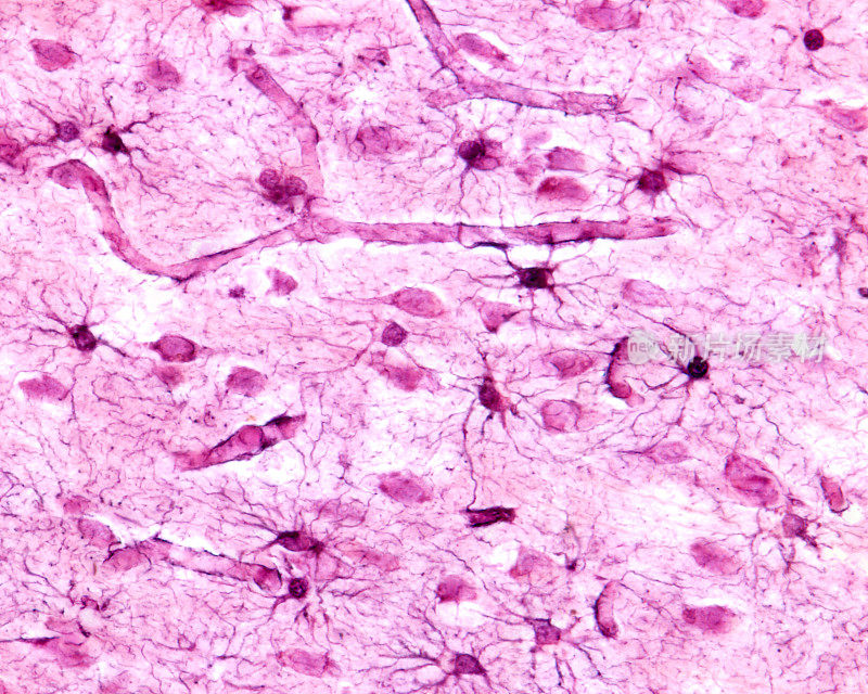 大脑皮层。原生质的星形胶质细胞