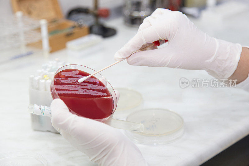 医学微生物实验室细菌菌落