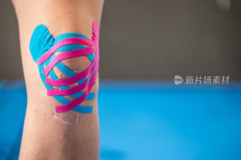 理疗师将运动机能学胶带应用于女性膝盖