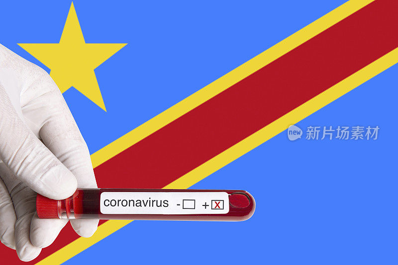 冠状病毒在刚果