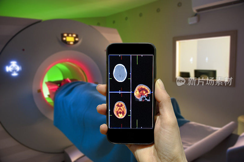 智能手机医疗扫描应用程序