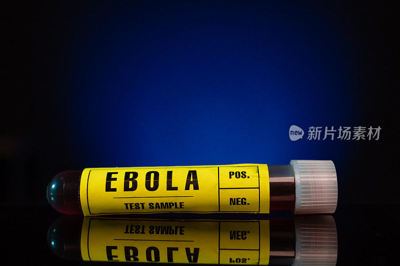 埃博拉病毒血样检测试管特写黄色标签，蓝色背景