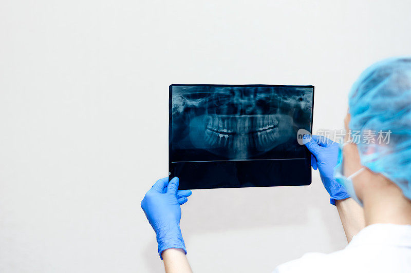 电脑断层扫描CT扫描牙齿在牙医的手上戴着手套。人类下巴的x光片。本空间