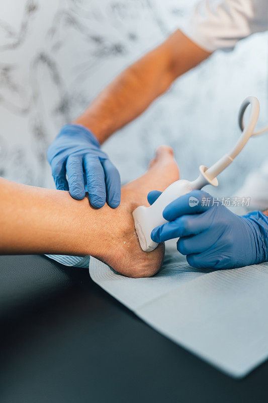 足科医生正在给病人的脚做超声波检查。