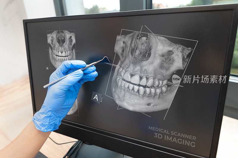 牙科咨询与三维断层成像