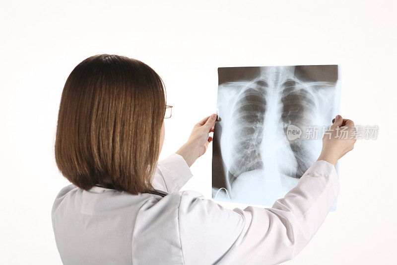 女医生在看肺部x光片