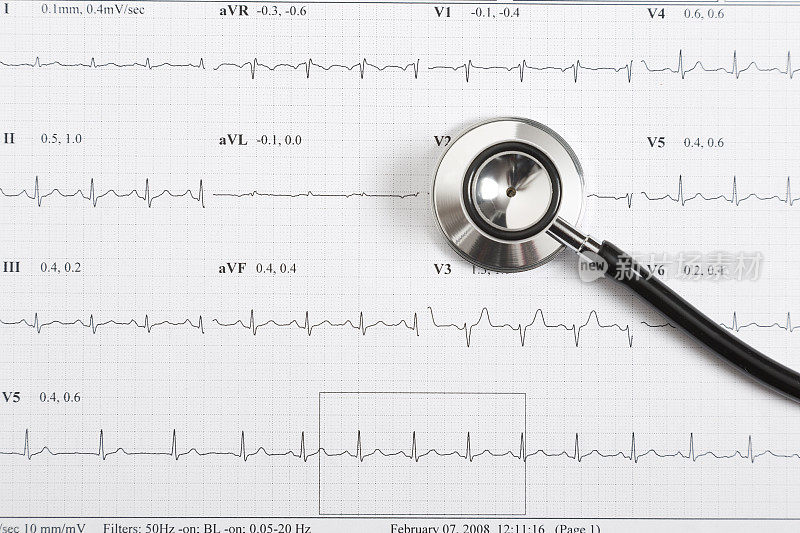 心电图和听诊器