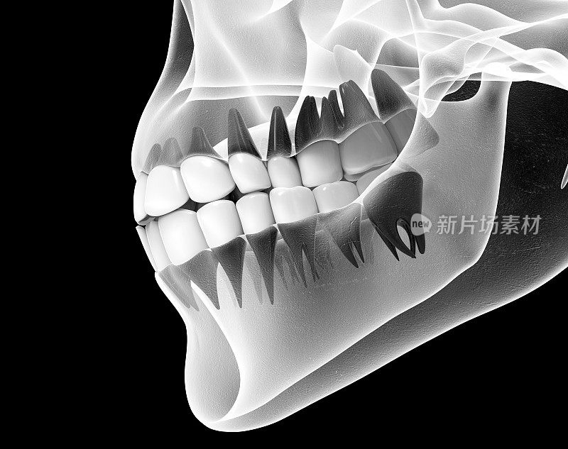 带有牙齿的颌的x光图像