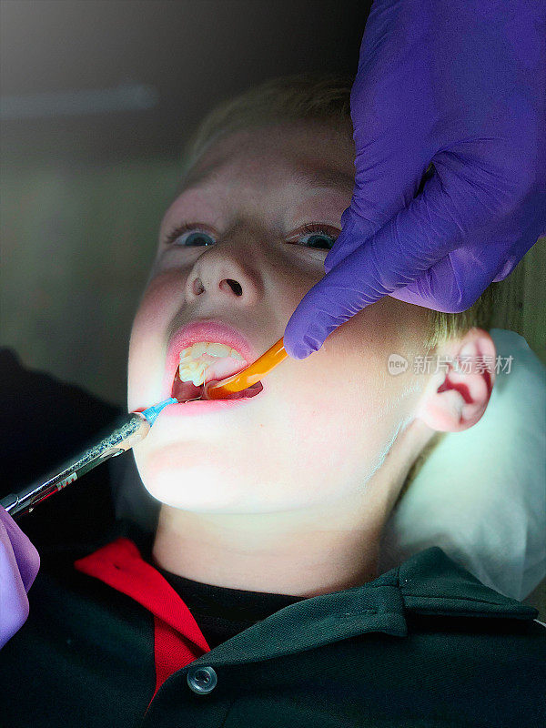 牙科医生使用注射器局部麻醉拔牙