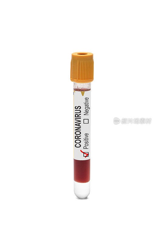 冠状病毒阳性血液样本