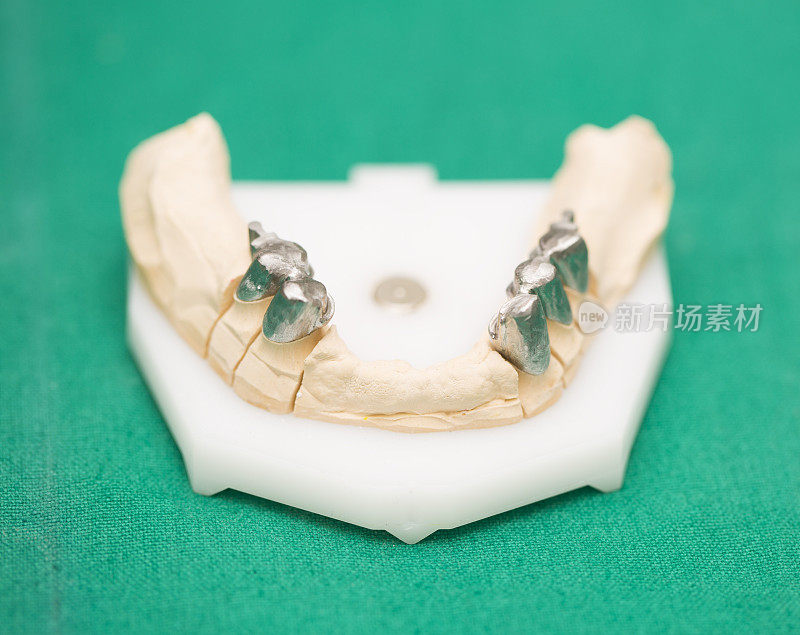 牙科修复体制造
