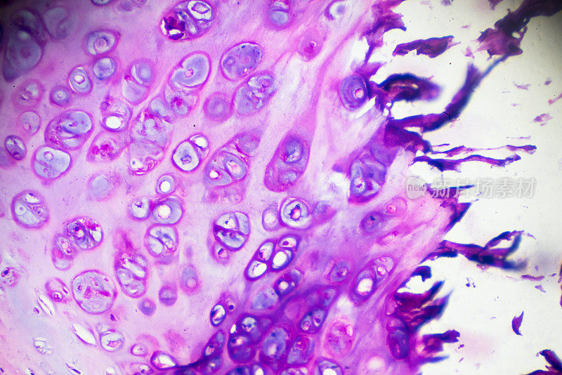 慢性支气管炎不同部位显微镜放大