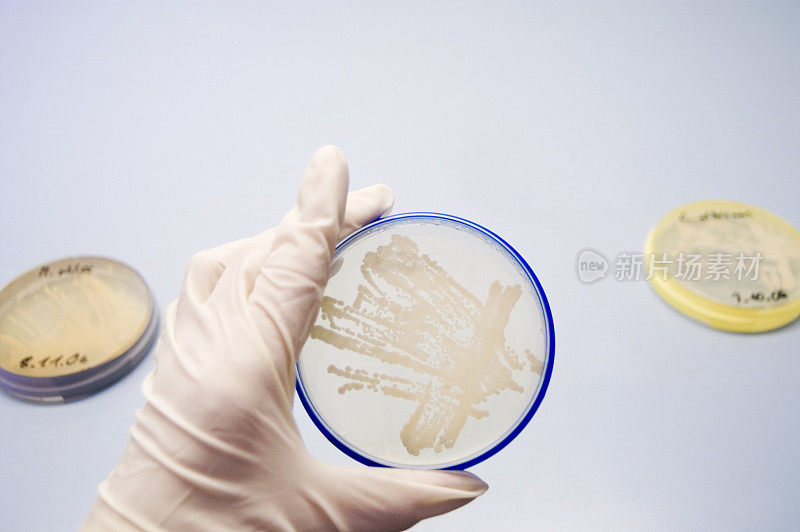 琼脂平板培养微生物细菌