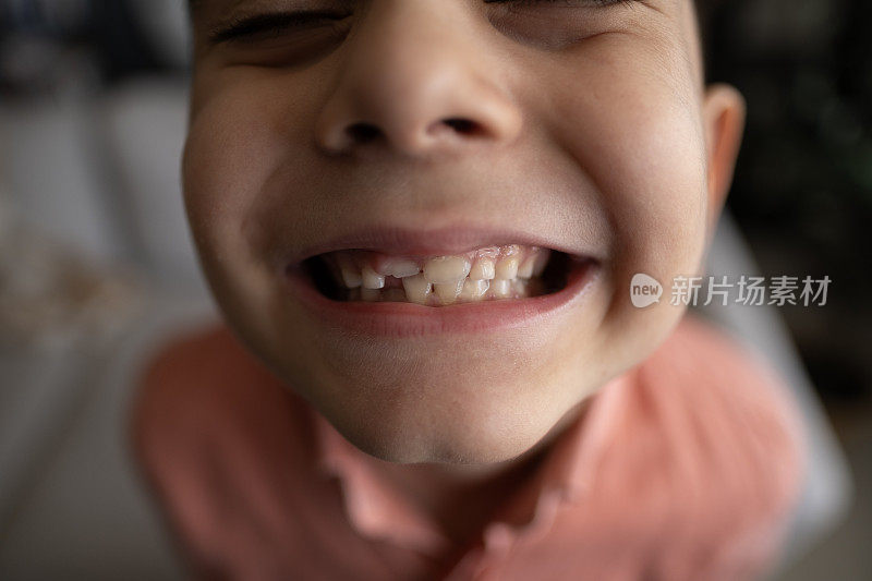 近口小孩掉了一颗乳牙。更换恒换牙、无牙微笑、牙龈破洞。儿童牙科概念