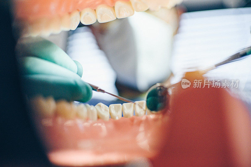 牙医检查牙齿-从口腔内角度
