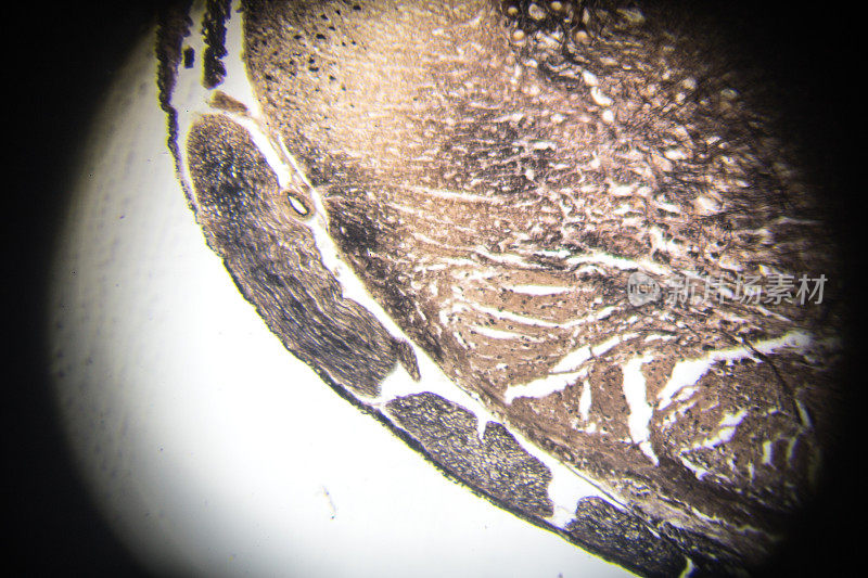 显微镜下脊髓横切面