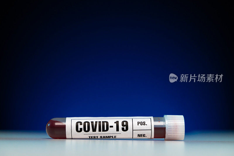 COVID-19(冠状病毒)血液检测样管特写