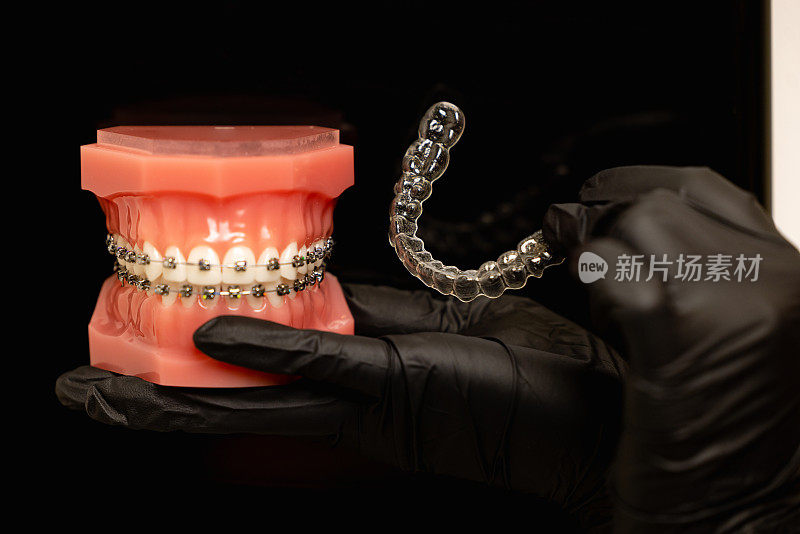 口腔防护器和牙齿模型，牙齿上有牙套