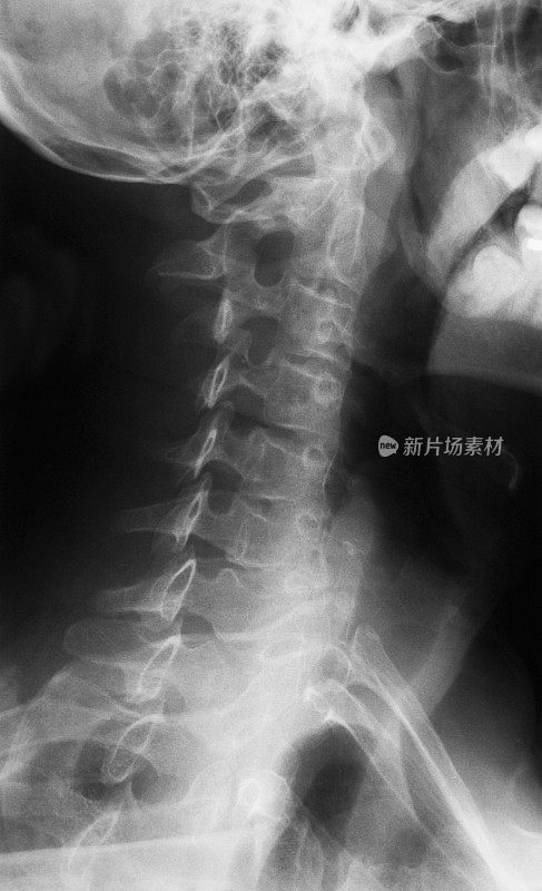 颈部和颅底x光片