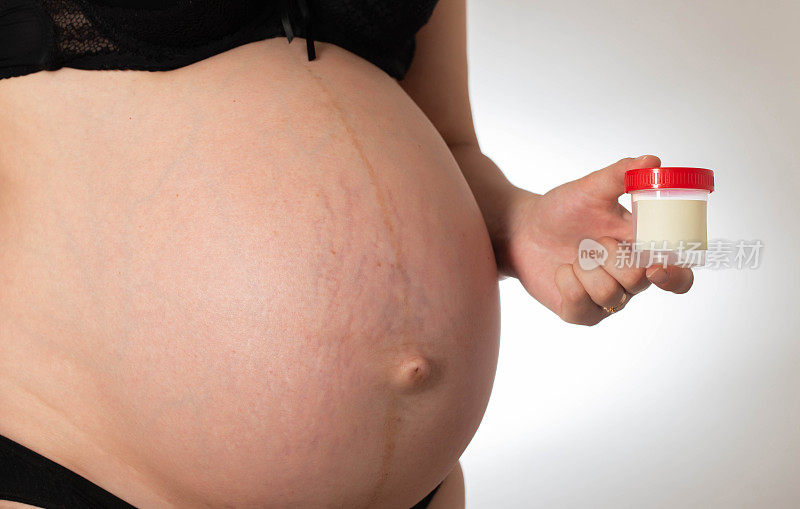 一个怀孕的女孩手里拿着一个罐子，用来收集尿样。妊娠期Koznept尿分析，尿中蛋白质和丙酮。生殖器感染、细菌与子痫前期的研究。