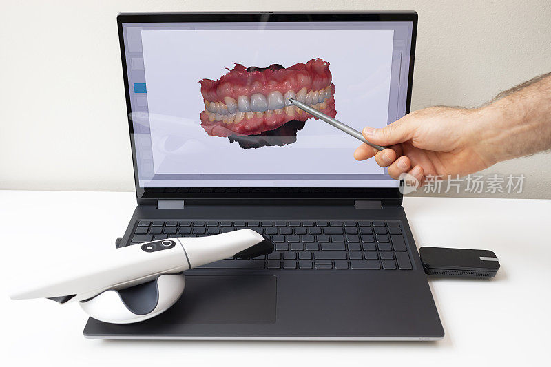 牙医在电脑显示器上显示扫描牙齿的3D扫描图片。白色3d口腔内牙齿扫描仪躺在桌子上。采购产品牙科设备，扫描牙齿的装置。牙医。水平