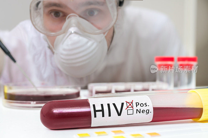 有血液的试管用于HIV检测
