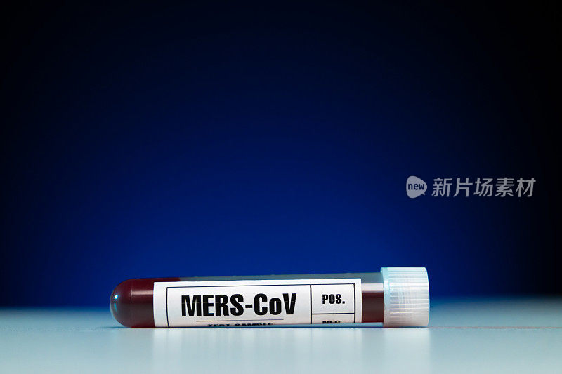 MERS-CoV病毒血样检测试管特写