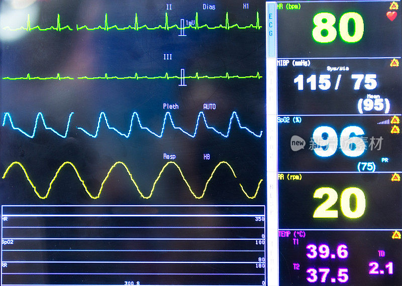 心脏监护仪生命统计