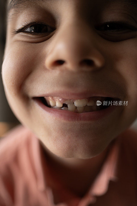 近口小孩掉了一颗乳牙。更换恒换牙、无牙微笑、牙龈破洞。儿童牙科概念