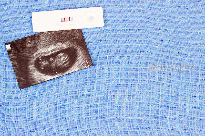 孕检及超声波扫描婴儿背景尿不湿，待产婴儿
