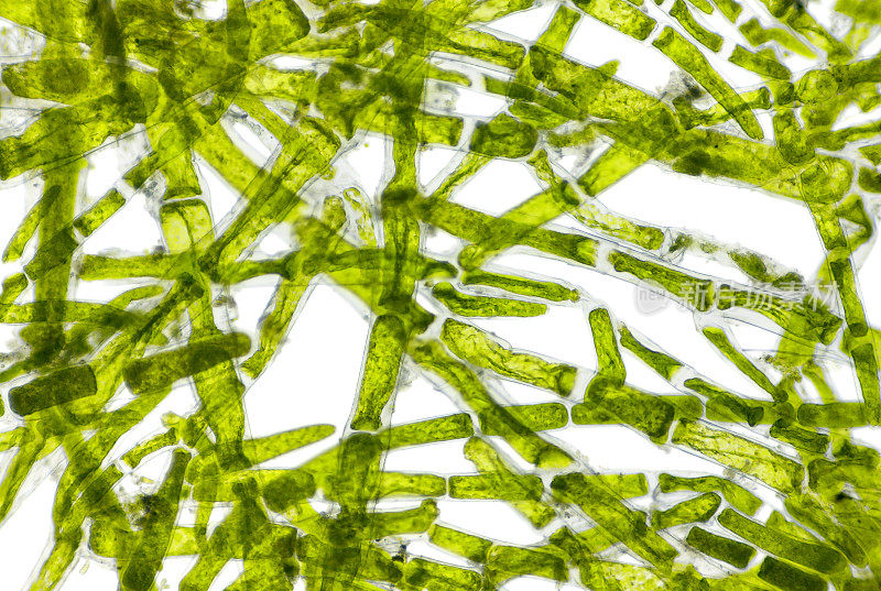 绿藻(Cladophora)细胞的显微镜视图