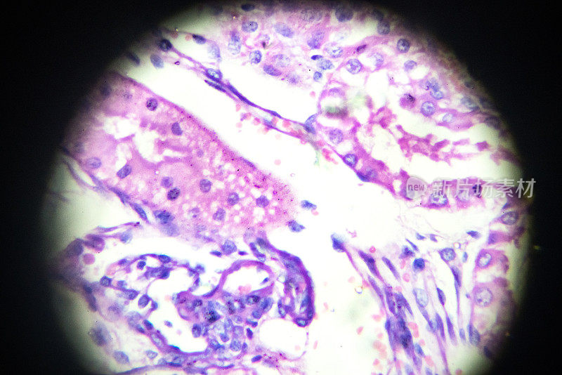 显微镜下肾脏横切面