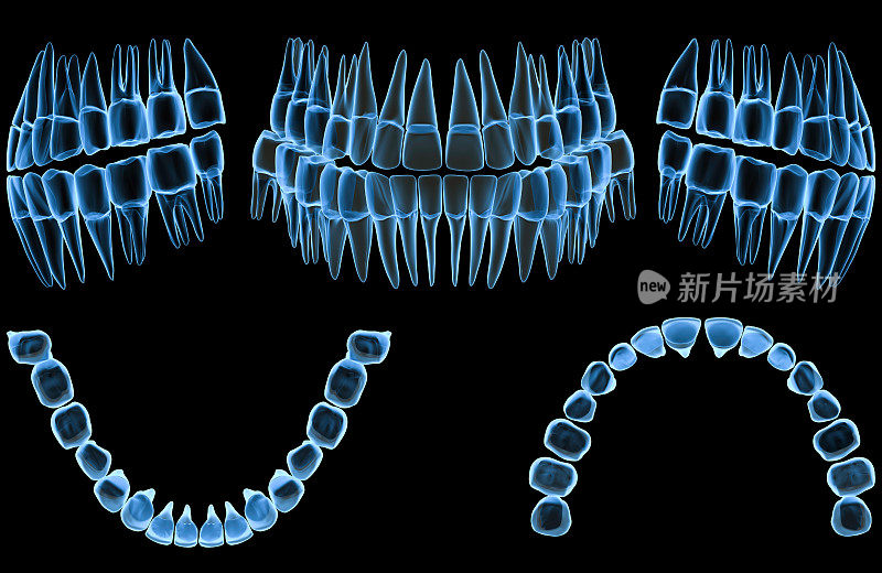 x射线teeth-5视图