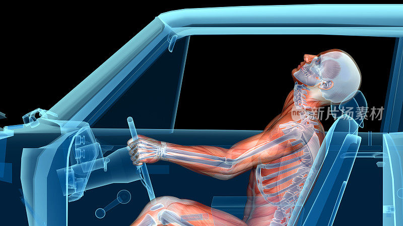 人体解剖在一场车祸中，肌肉和骨骼