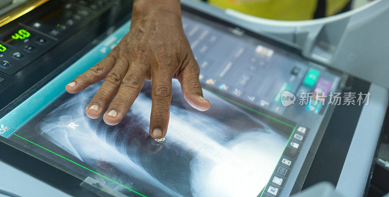数字x光机中的胸部x光机与放射科医生在医院诊断病人健康。医疗放射保健概念。