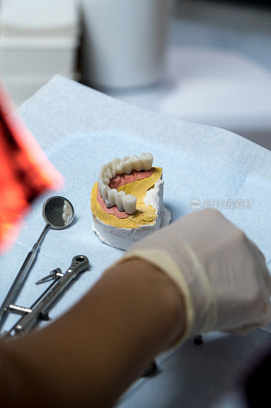牙医种植上牙
