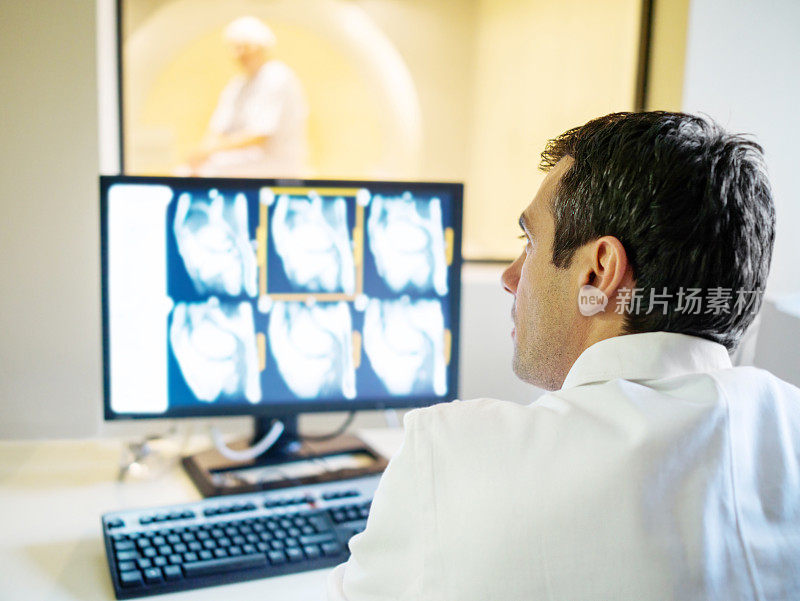 放射科医生检查核磁共振扫描。