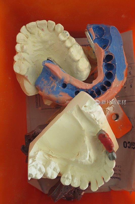 牙科技师修复牙齿