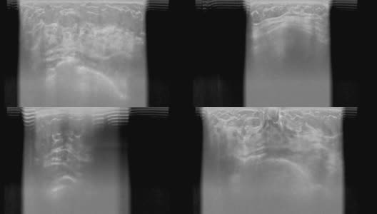乳房超声或x光检查高清在线视频素材下载