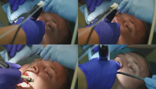 牙医钻牙高清在线视频素材下载
